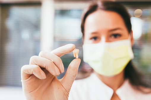 Photo of a dentist holding an extracted tooth